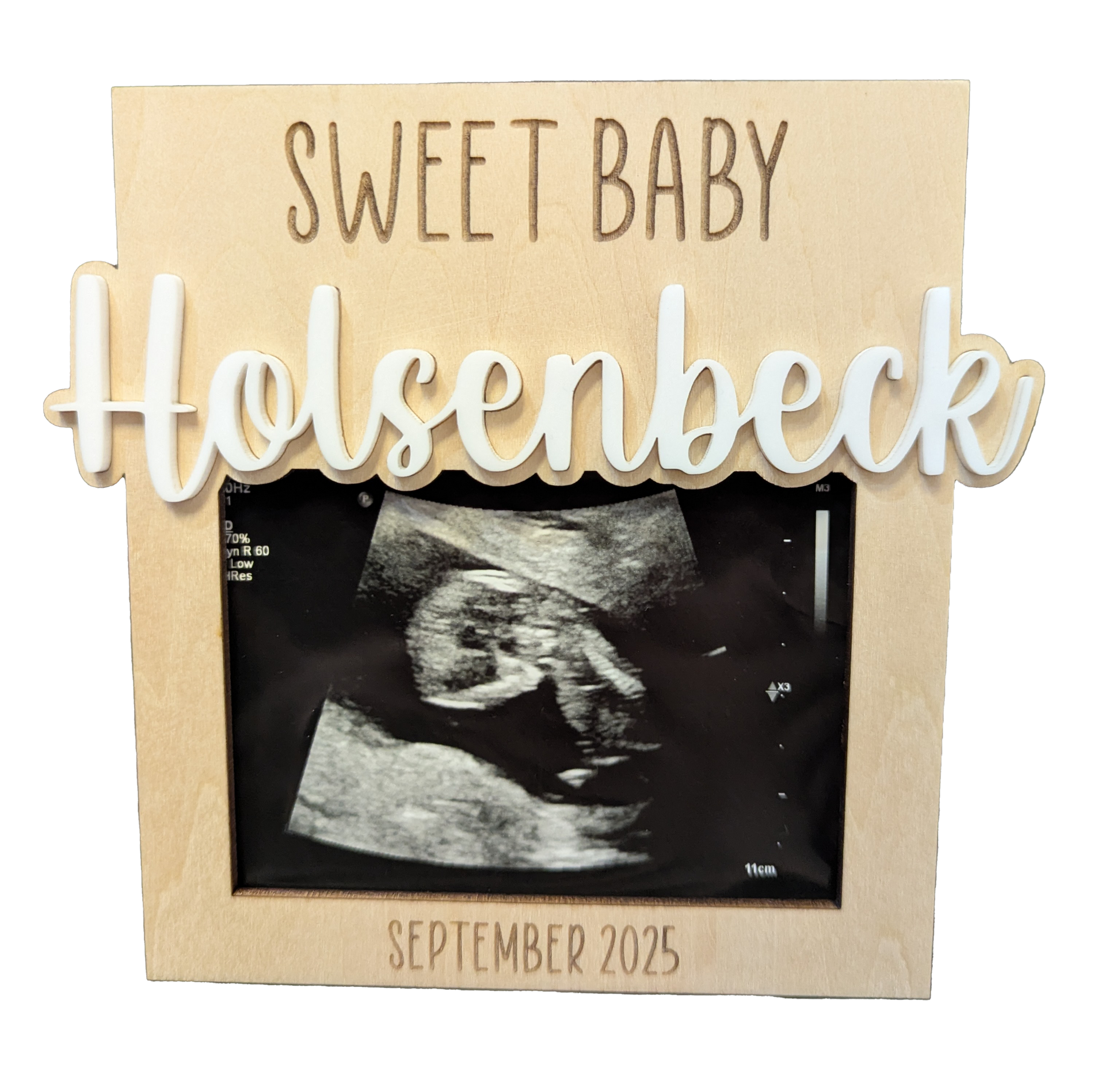 Personalized Ultrasound Magnetic Frame